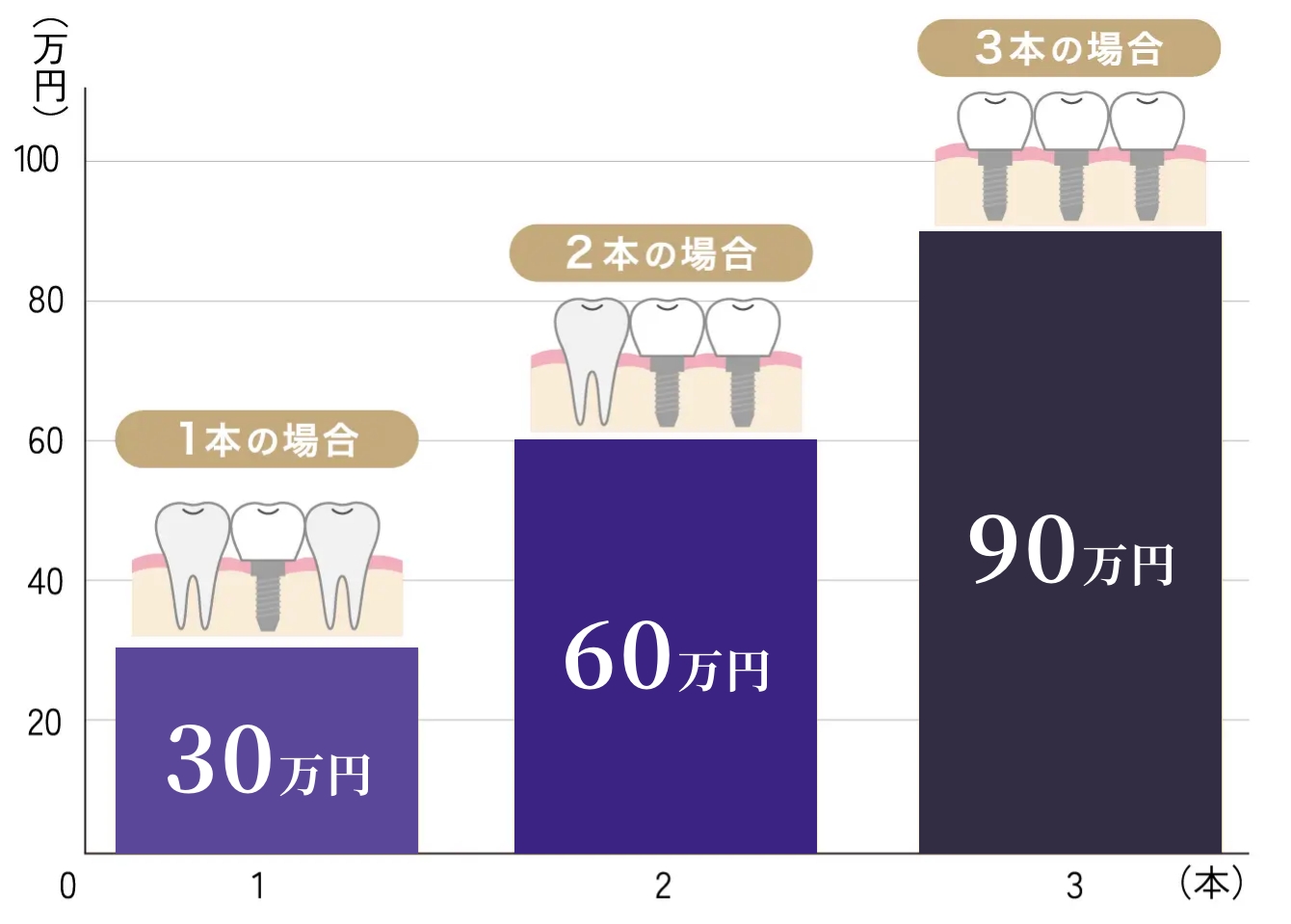 費用負担が大きくなる