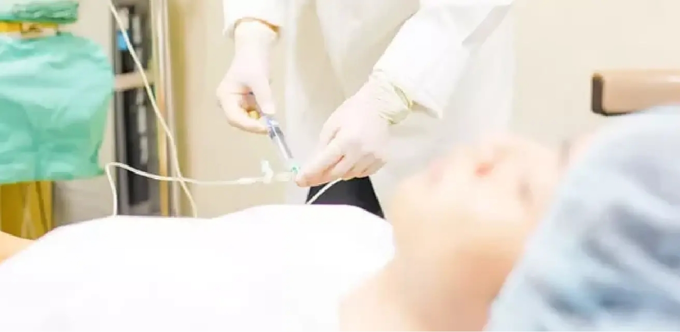 静脈内鎮静法とは